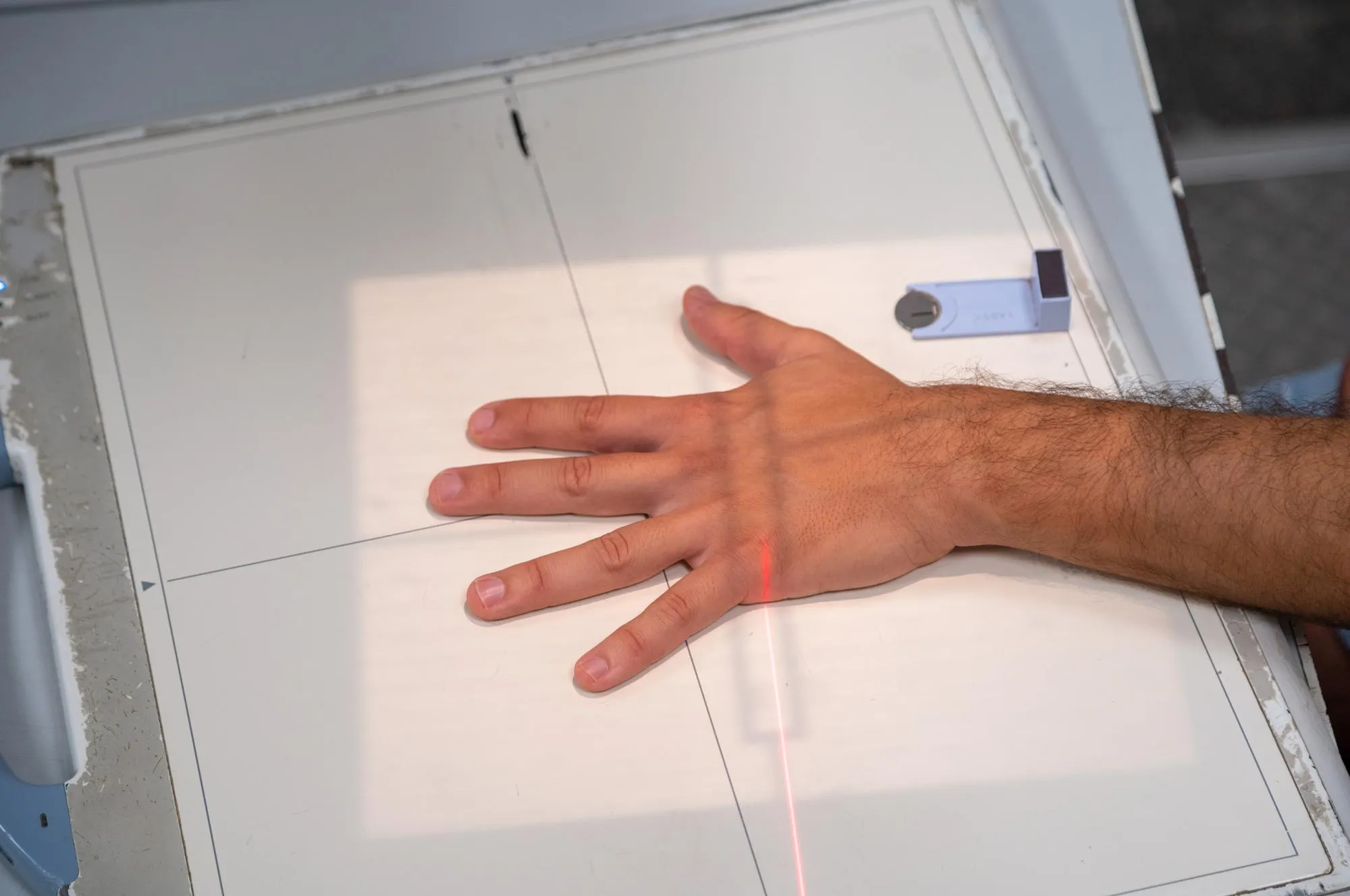 Close up of a hand x ray in session