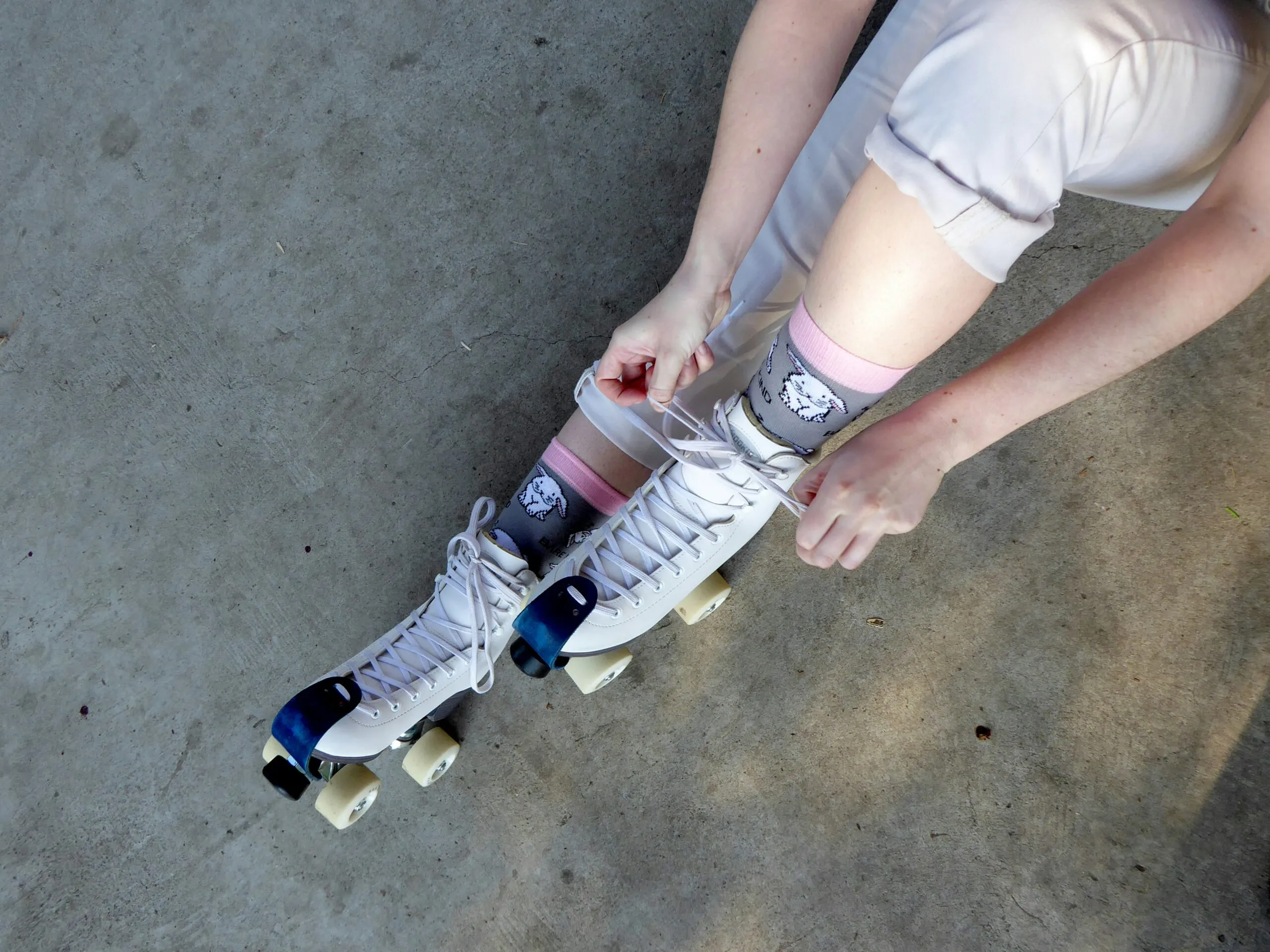 A person standing on a skateboard with a broken leg