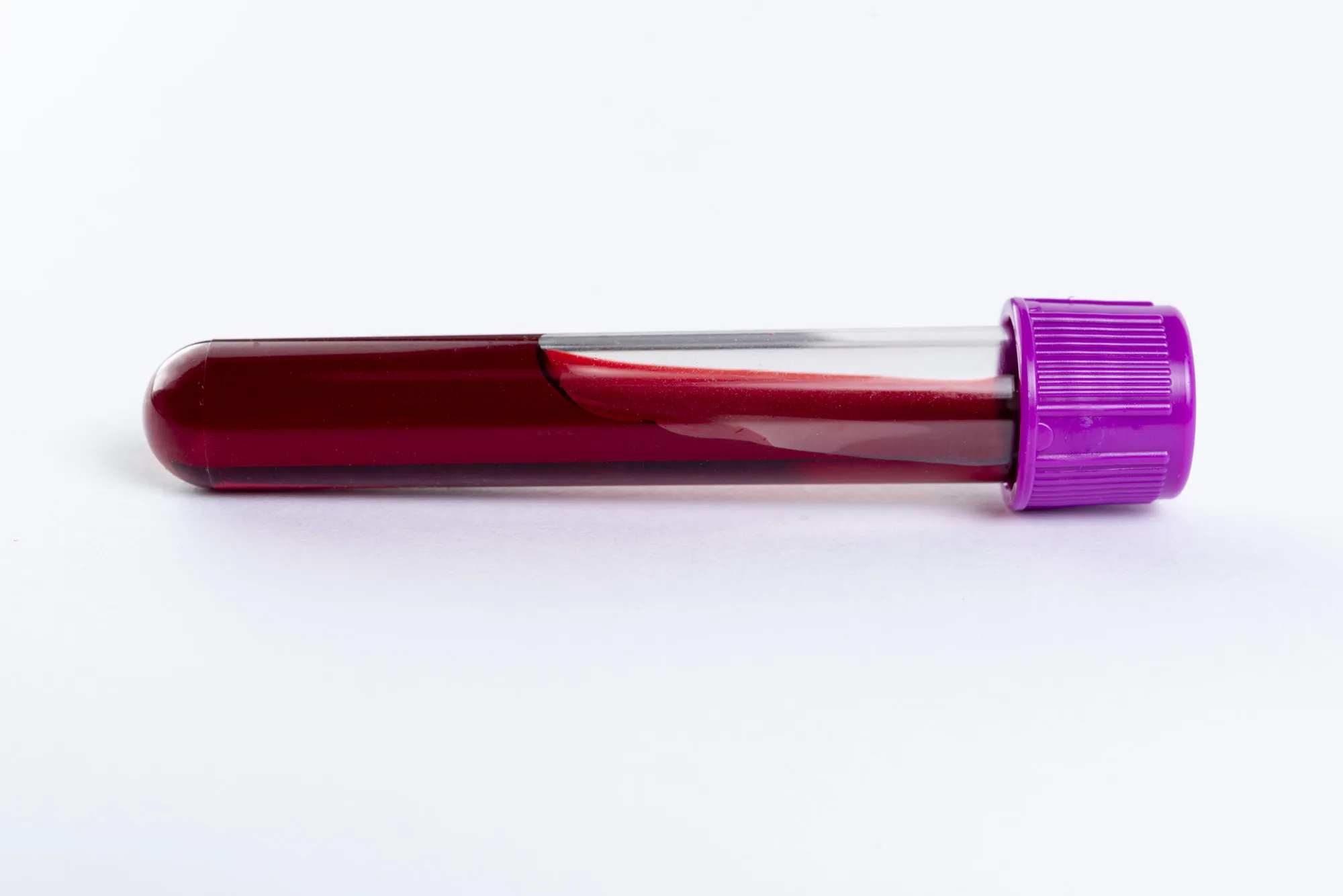 Tube with blood for blood test.