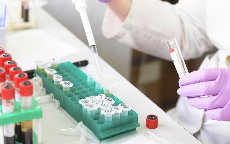 laboratory, medical, medicine, ręka, research, lab, test, doctor, equipment, scientist, kobieta, chemistry, science, hospital, experiment, osoba, technician, technology, healthcare, praca, health, tube, work, research lab, blood samples, laboratory, laboratory, laboratory, lab, lab, lab, lab, lab, doctor, chemistry, hospital, hospital