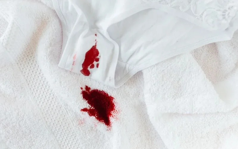 Close-up of menstrual blood stain on white underwear and towel, symbolizing period awareness.